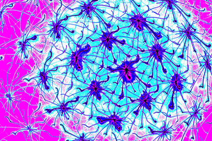PINKES NEURONALES NETZ — Premium Kunstprint