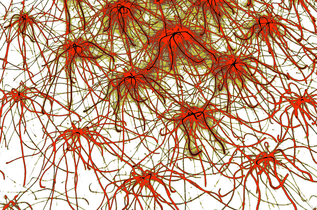 ROTE STERNE NEURONEN — Premium Kunstprint