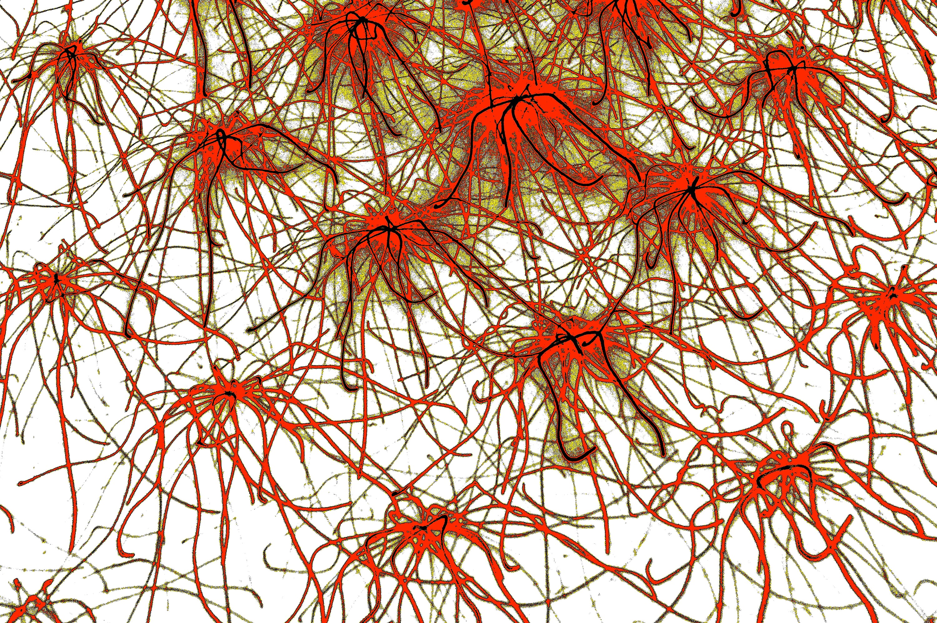ROTE STERNE NEURONEN — Premium Kunstprint