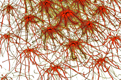 ROTE STERNE NEURONEN — Premium Kunstprint